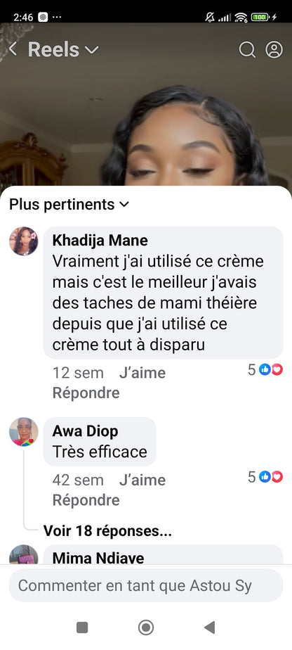 Créme miracle anti imperfections Miyodi (boutons,ride,mami , hyperpigmentation,melasma,entre jambes noirs,fard,acnés,pores dilatés, rougeurs Resultat visible en 7j)tout type de peau