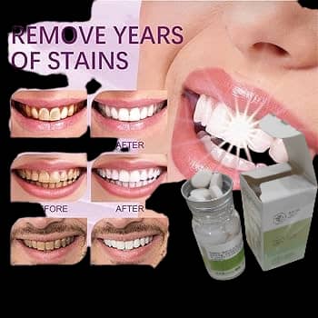 Pastille dentifrice pour blanchir les dents et traitée la mauvaise haleine en 30s très efficace et sans effets secondaires livraison gratuite vers certaines zone