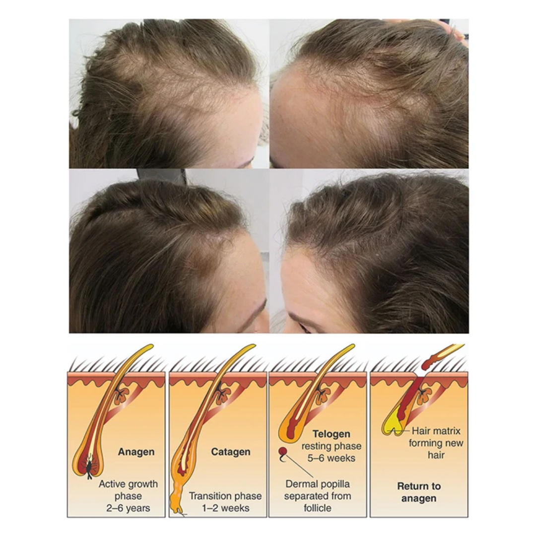 HUILE MIRACLE MIYODI CHEVEUX BARBE, CALVITIE ET ALOPÉCIE POUR HOMMES FEMMES ET ENFANTS TRÈS EFFICACE RESULTAT RAPIDE