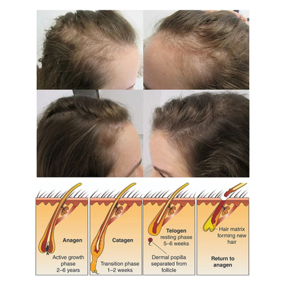 HUILE MIRACLE MIYODI CHEVEUX BARBE, CALVITIE ET ALOPÉCIE POUR HOMMES FEMMES ET ENFANTS TRÈS EFFICACE RESULTAT RAPIDE